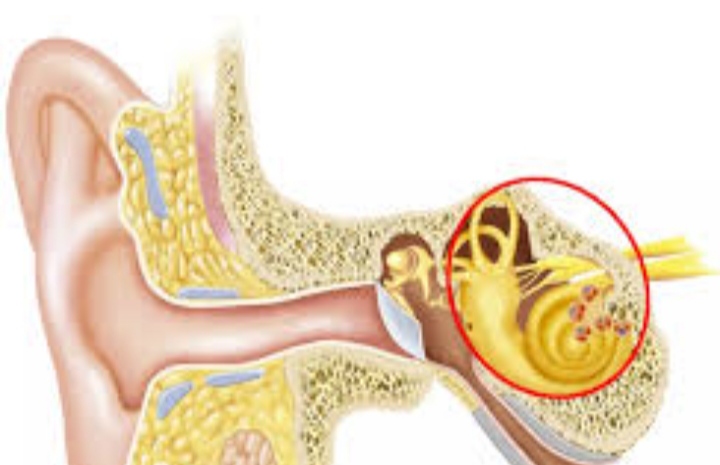 OTOLITI COS'E QUESTA PATOLOGIA: LA MELONI NE SOFFRE?